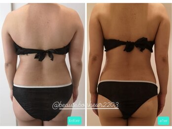 ボーテボナー(Beaute Bonheur)/♪痩身ボディ♪