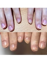 サンマルイチ(301)/自爪育成／クリア