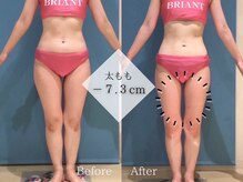 ピュアエステ ブリアント 新宿店/お客様の結果［新宿/痩身］