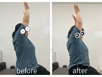 ナオル整体 大里院(NAORU整体)/肩がこりすぎて上げにくい