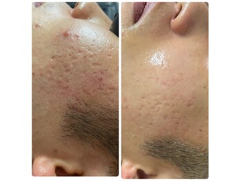 サイエンスビューティー ケイ ティ(K T)