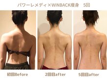 リトリト(Retreat)/5回目ビフォアフター