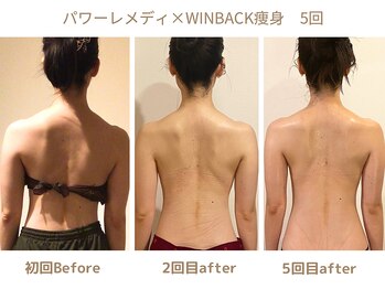 リトリト(Retreat)/5回目ビフォアフター