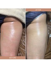 タミー(tummy)/キュッ！美尻へ！