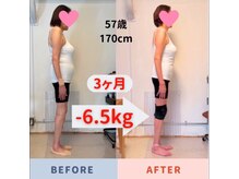 ナチュールフィット(Natur Fit)/57歳　ビフォーアフター