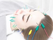 伊藤接骨院の雰囲気（人気の美容鍼もご体感ください◎【肩こり/腰痛/鍼灸/美容鍼】）