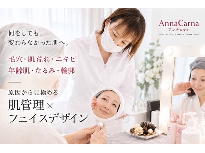 アンナカルナ(AnnaCarna)の写真