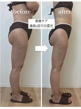 ルミノ 心斎橋(Rumino)/術後ケア