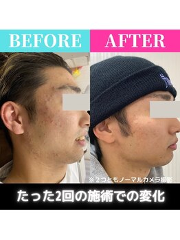 医療提携サロン/メンズフェイシャル施術