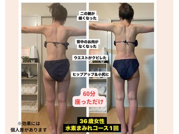 ヨサパーク リプル(YOSA PARK Ripples)