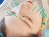 【夏休み期間限定☆】旅行前に"映える小顔"をつくる電気を流す美容鍼コース