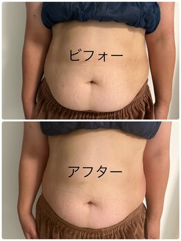 メディカルエステ ユウ(Yuu)/