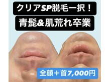 ディサイドロー(DECIDE L.A.W)の雰囲気（脱毛初心者さんも多くご来店頂いてます★）
