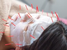 べっぷ餅ヶ浜鍼灸院