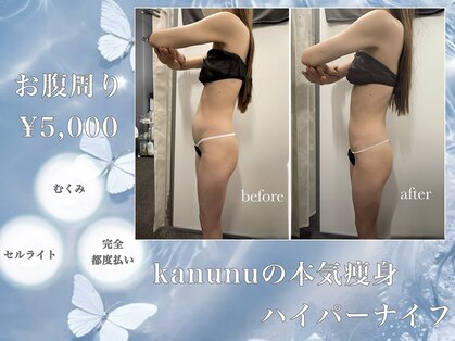 カヌヌ(kanunu)の写真