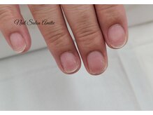 ネイルサロン アミティエ(Nail Salon Amitie)/ダメージ爪も改善⇒土台を整える
