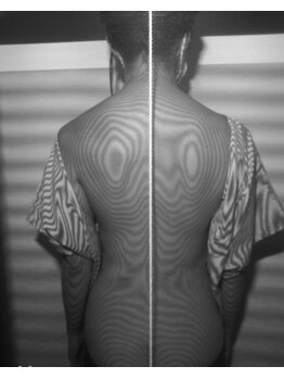 新リンパサロン 大阪/骨格の歪みを写真で確認できます