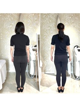 セレーネボーテプラス/