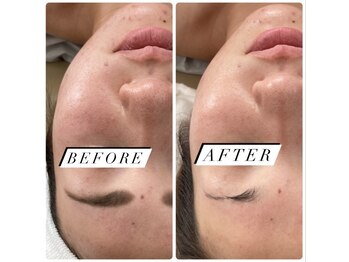 フフレ(fufre)/老化肌と小顔に◎艶感も◎