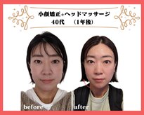 ビュート