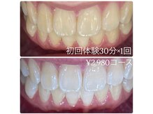 ホワイトニングルーム 横浜店(Whitening Room)/ホワイトニングサロン横浜