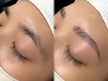 イーアップ(e-up)/アイブロウリフト