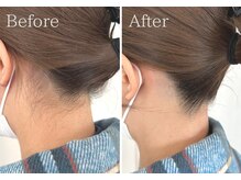 レイジア 刈谷の雰囲気（男女OKのスキンケア&脱毛サロン！効果で選ぶならレイジア◎）