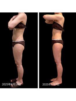 クールヴィラ(Cool Villa)/