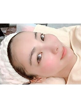 小顔になりたい