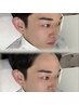 第一印象が変わる｜メンズ眉毛WAX