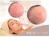 【美肌への入り口は脱毛から】 顔脱毛(クレンジング・パック付)¥9900→