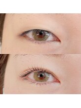 ありる/一重さんマツパ