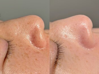 ルーナジェーナ(Luna llena)/池袋 エステ ルーナジェーナ