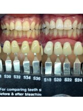 トウキョウスワーズ 池袋店(TOKYO SWRS)/#ホワイトニング #池袋 #渋谷