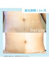 メンズクリア 武蔵小杉店/【メンズクリア】お客様の施術例