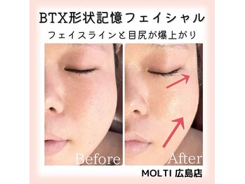 モルティー 広島店(Molti)/輪郭・目尻引き上がり