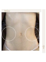 ファロンビューティー(fallon beauty)/インド式マッサージ