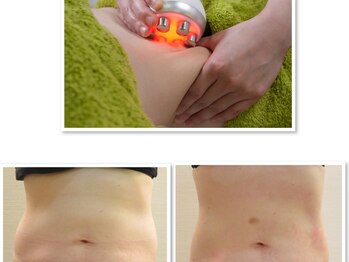 デイスパ ヴィータの写真/【40代限定の痩身】上半身、そのやり方では痩せません