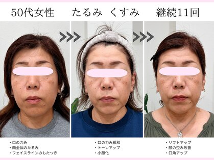 美容整体 ソワンの写真
