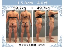 ボディエステティック アクアオーラ 富山店