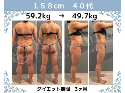 ボディエステティック アクアオーラ 富山店の写真