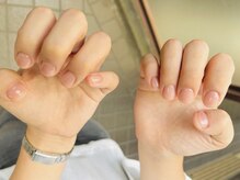 アトリエ メイド(atelier made)/深爪改善￥3,990