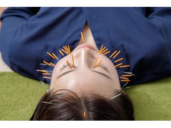 ハリエイド(HARI AID)/美容鍼