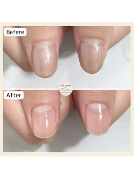 他店様オフ(無料)+ネイルケア