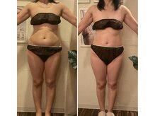 トータルビューティーサロン 凛の雰囲気（痩せにくい50代以上でも、ダイエット成功！健康診断前に◎）