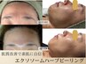 【毛穴・くすみ・ごわつき・ハリ改善】エクソソームハーブピーリング/70分