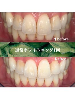 フタバ 天神大名店(futaba)/男性も清潔感のあるきれいな歯へ