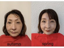 ウェルフル(Well Full)/52才とは思えない可愛さ♪