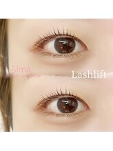 アルマ(Alma.)/ラッシュリフト