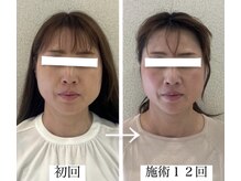 ラボーテヴェリテ(La Beaute Verite)/【お客様施術例】